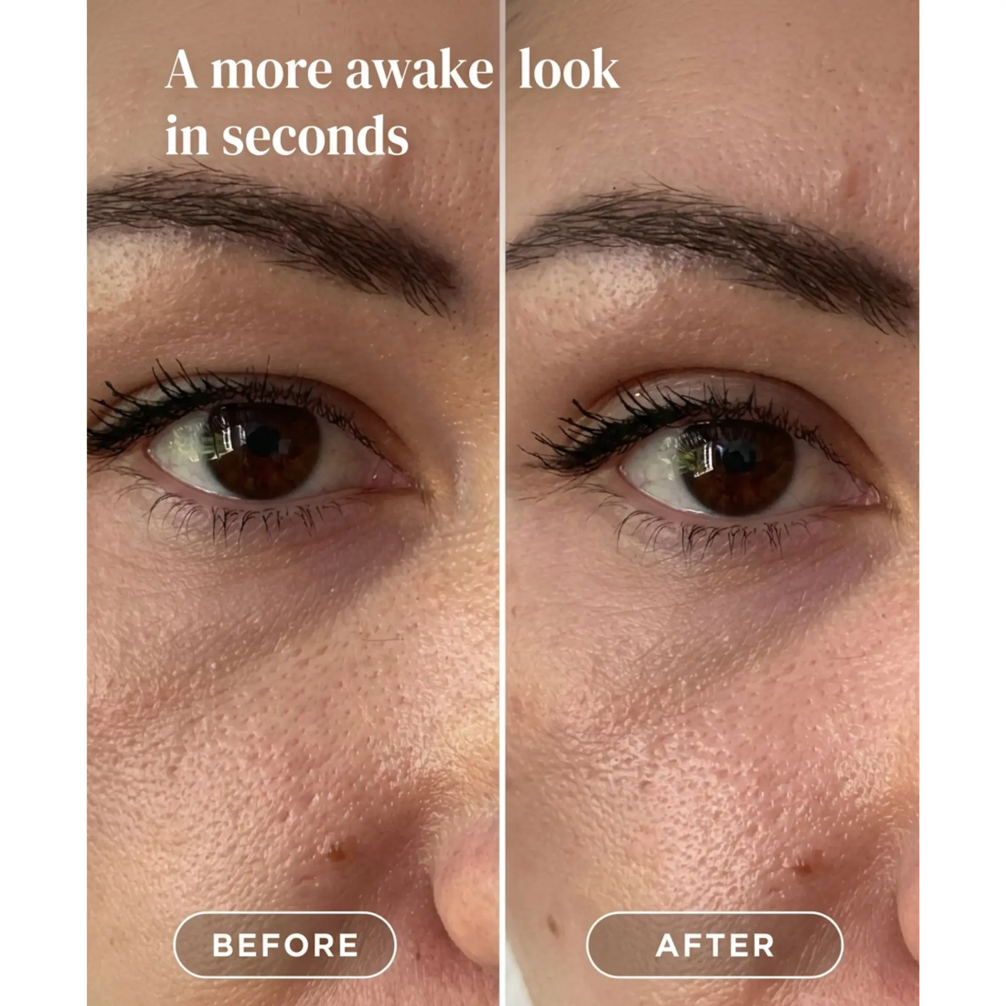 Eyelid Lifting Tapes - Image 7