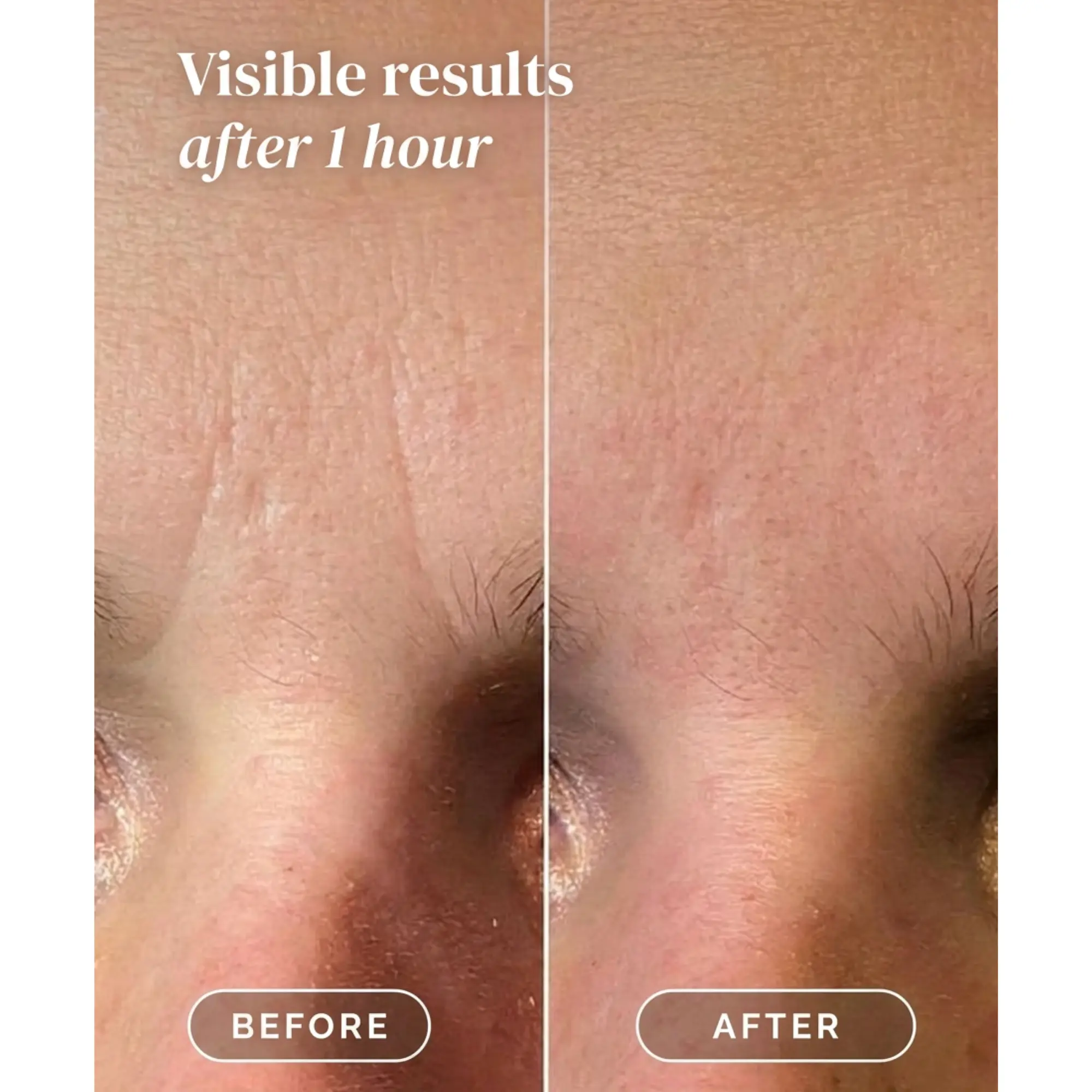 Facial Patches Niacinamide - Image 7