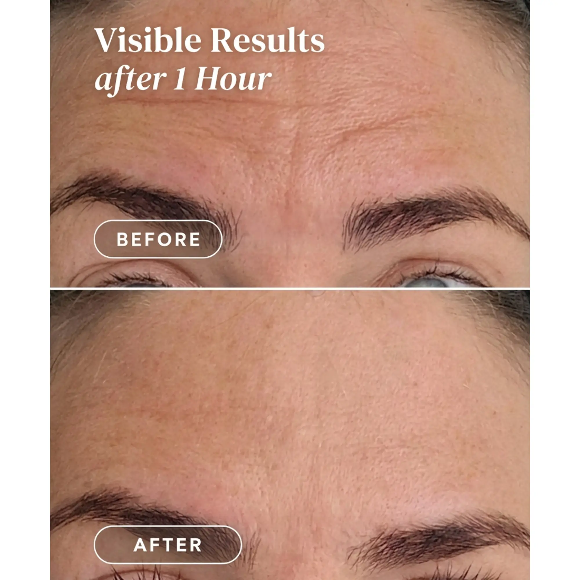 Forehead Pad Ectoin - Image 7