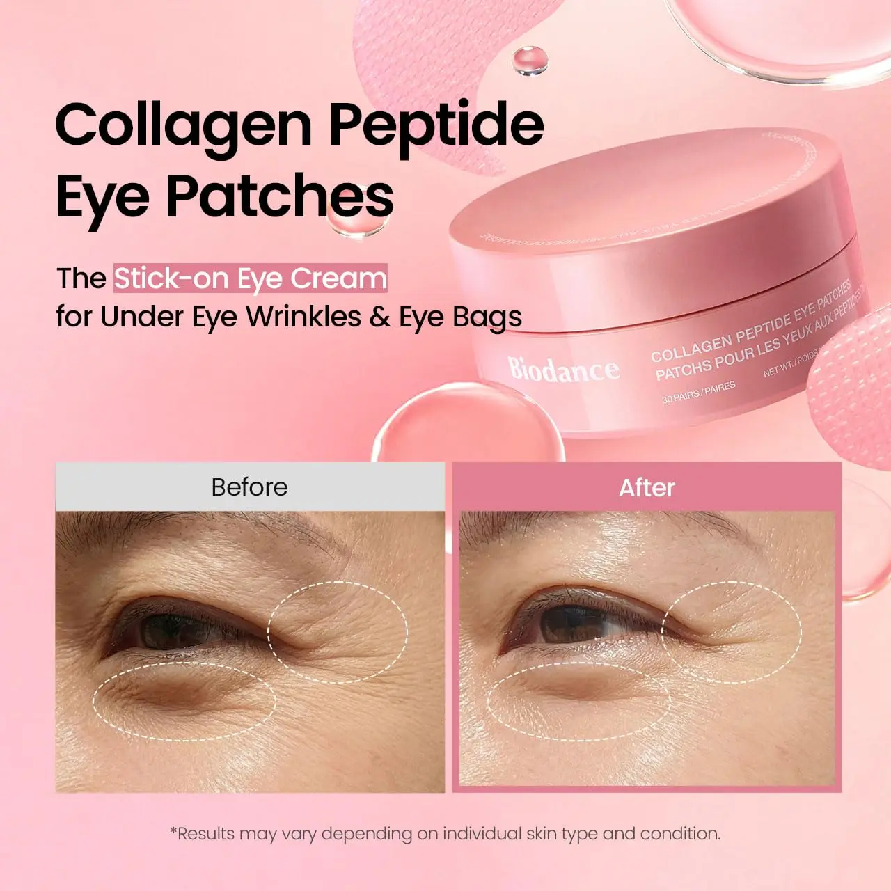 Collagen Peptide Eye Patches - Image 3