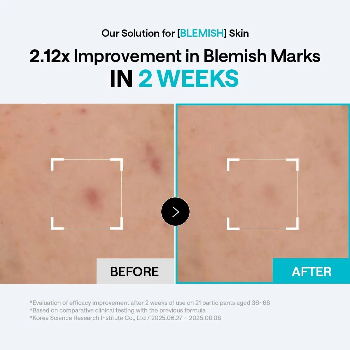 Madecassoside Blemish Pad - Image 4