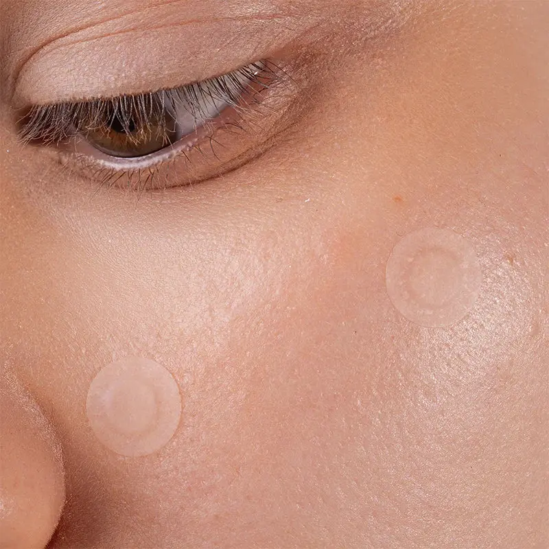 Spot the F Off Invisible Blemish Patches - Image 2